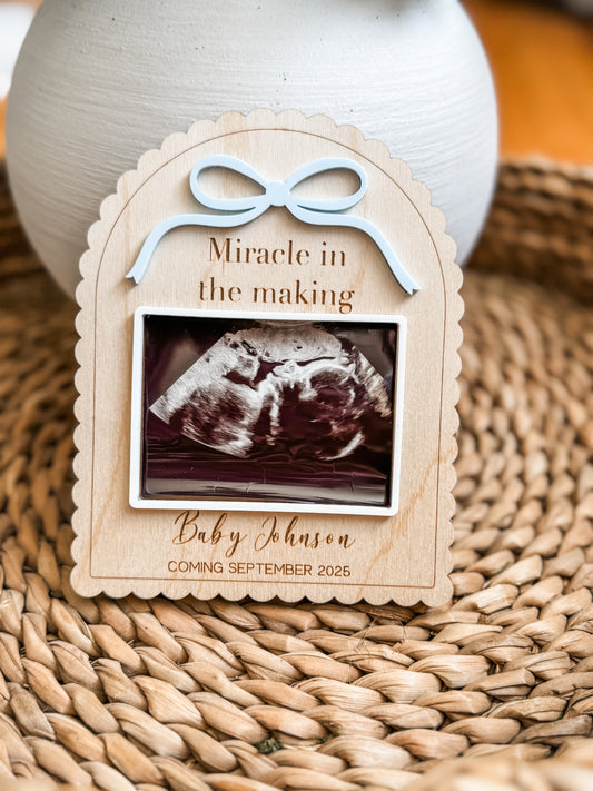 Ultrasound Frame Fridge Magnet (Personalized)